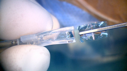 告别15年近视困扰:27岁小伙勇当深圳首位龙晶®PR晶体体验者(图3)